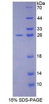 CDH13 / Cadherin 13 Protein - Recombinant  Cadherin, Heart By SDS-PAGE