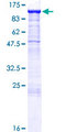 CDH16 / Cadherin 16 Protein - 12.5% SDS-PAGE of human CDH16 stained with Coomassie Blue