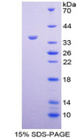 CDH17 / Cadherin 17 Protein - Recombinant  Cadherin 17 By SDS-PAGE