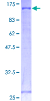 CDH18 / Ey-Cadherin Protein - 12.5% SDS-PAGE of human CDH18 stained with Coomassie Blue