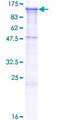 CDH19 / Cadherin 19 Protein - 12.5% SDS-PAGE of human CDH19 stained with Coomassie Blue