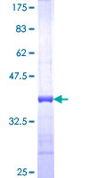 CDH19 / Cadherin 19 Protein - 12.5% SDS-PAGE Stained with Coomassie Blue.