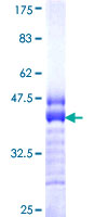 CDH2 / N Cadherin Protein - 12.5% SDS-PAGE Stained with Coomassie Blue.