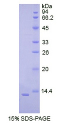 CDH2 / N Cadherin Protein - Recombinant Cadherin, Neuronal By SDS-PAGE