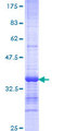 CDH23 / Cadherin 23 Protein - 12.5% SDS-PAGE Stained with Coomassie Blue.