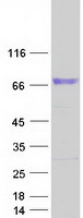 CDH23 / Cadherin 23 Protein - Purified recombinant protein CDH23 was analyzed by SDS-PAGE gel and Coomassie Blue Staining