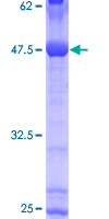 CDH26 / Cadherin 26 Protein - 12.5% SDS-PAGE of human CDH26 stained with Coomassie Blue