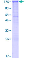 CDH3 / P-Cadherin Protein - 12.5% SDS-PAGE of human CDH3 stained with Coomassie Blue