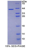 CDH3 / P-Cadherin Protein - Recombinant Cadherin, Placental By SDS-PAGE