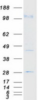 CDH3 / P-Cadherin Protein - Purified recombinant protein CDH3 was analyzed by SDS-PAGE gel and Coomassie Blue Staining