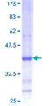 CDH4 / R Cadherin Protein - 12.5% SDS-PAGE Stained with Coomassie Blue.