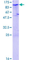 CDH6 / K Cadherin Protein - 12.5% SDS-PAGE of human CDH6 stained with Coomassie Blue
