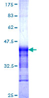 CDH6 / K Cadherin Protein - 12.5% SDS-PAGE Stained with Coomassie Blue