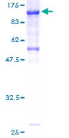 CDH7 / Cadherin 7 Protein - 12.5% SDS-PAGE of human CDH7 stained with Coomassie Blue