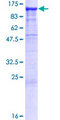 CDH8 / Cadherin 8 Protein - 12.5% SDS-PAGE of human CDH8 stained with Coomassie Blue