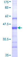 CDHR5 / MUCDHL Protein - 12.5% SDS-PAGE Stained with Coomassie Blue.