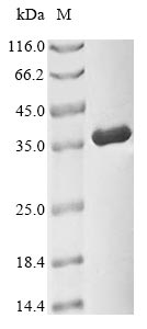 CDK1 / CDC2 Protein - (Tris-Glycine gel) Discontinuous SDS-PAGE (reduced) with 5% enrichment gel and 15% separation gel.
