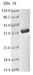 CDK1 / CDC2 Protein - (Tris-Glycine gel) Discontinuous SDS-PAGE (reduced) with 5% enrichment gel and 15% separation gel.