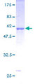 CDK1 / CDC2 Protein - 12.5% SDS-PAGE of human CDC2 stained with Coomassie Blue