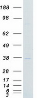CDK1 / CDC2 Protein - Purified recombinant protein CDK1 was analyzed by SDS-PAGE gel and Coomassie Blue Staining