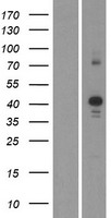 CDK10 Protein - Western validation with an anti-DDK antibody * L: Control HEK293 lysate R: Over-expression lysate