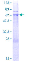 CDK10 Protein - 12.5% SDS-PAGE of human CDK10 stained with Coomassie Blue