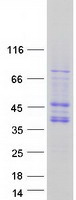 CDK10 Protein - Purified recombinant protein CDK10 was analyzed by SDS-PAGE gel and Coomassie Blue Staining