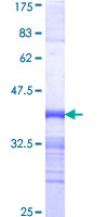 CDK12 / CRKRS Protein