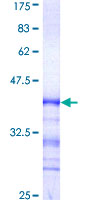 CDK13 / CDC2L5 Protein - 12.5% SDS-PAGE Stained with Coomassie Blue.