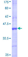 CDK15 / ALS2CR7 Protein
