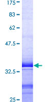 CDK16 / PCTAIRE Protein - 12.5% SDS-PAGE Stained with Coomassie Blue.