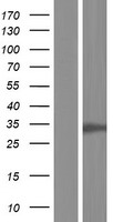 CDK2 Protein - Western validation with an anti-DDK antibody * L: Control HEK293 lysate R: Over-expression lysate