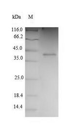 CDK2 Protein - (Tris-Glycine gel) Discontinuous SDS-PAGE (reduced) with 5% enrichment gel and 15% separation gel.