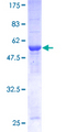 CDK2 Protein - 12.5% SDS-PAGE of human CDK2 stained with Coomassie Blue