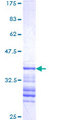 CDK2 Protein - 12.5% SDS-PAGE Stained with Coomassie Blue.