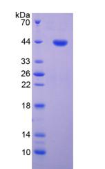 CDK2 Protein - Recombinant Cyclin Dependent Kinase 2 By SDS-PAGE