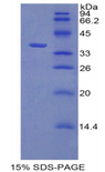 CDK2 Protein - Recombinant Cyclin Dependent Kinase 2 (CDK2) by SDS-PAGE