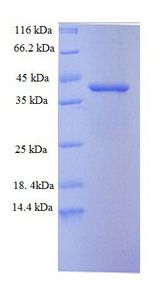 CDK2AP1 / DOC1 Protein
