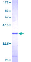 CDK2AP1 / DOC1 Protein - 12.5% SDS-PAGE of human CDK2AP1 stained with Coomassie Blue