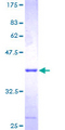 CDK2AP1 / DOC1 Protein - 12.5% SDS-PAGE of human CDK2AP1 stained with Coomassie Blue