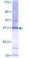 CDK2AP2 Protein - 12.5% SDS-PAGE of human CDK2AP2 stained with Coomassie Blue