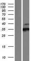 CDK3 Protein - Western validation with an anti-DDK antibody * L: Control HEK293 lysate R: Over-expression lysate