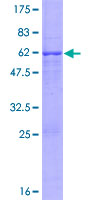 CDK3 Protein - 12.5% SDS-PAGE of human CDK3 stained with Coomassie Blue