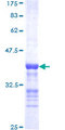 CDK3 Protein - 12.5% SDS-PAGE Stained with Coomassie Blue.