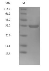 CDK4 Protein - (Tris-Glycine gel) Discontinuous SDS-PAGE (reduced) with 5% enrichment gel and 15% separation gel.
