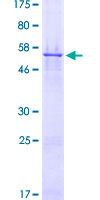 CDK4 Protein - 12.5% SDS-PAGE of human CDK4 stained with Coomassie Blue
