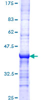 CDK4 Protein - 12.5% SDS-PAGE Stained with Coomassie Blue.