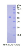 CDK4 Protein - Recombinant Cyclin Dependent Kinase 4 By SDS-PAGE