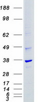 CDK4 Protein - Purified recombinant protein CDK4 was analyzed by SDS-PAGE gel and Coomassie Blue Staining