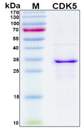 CDK5 Protein - SDS-PAGE under reducing conditions and visualized by Coomassie blue staining